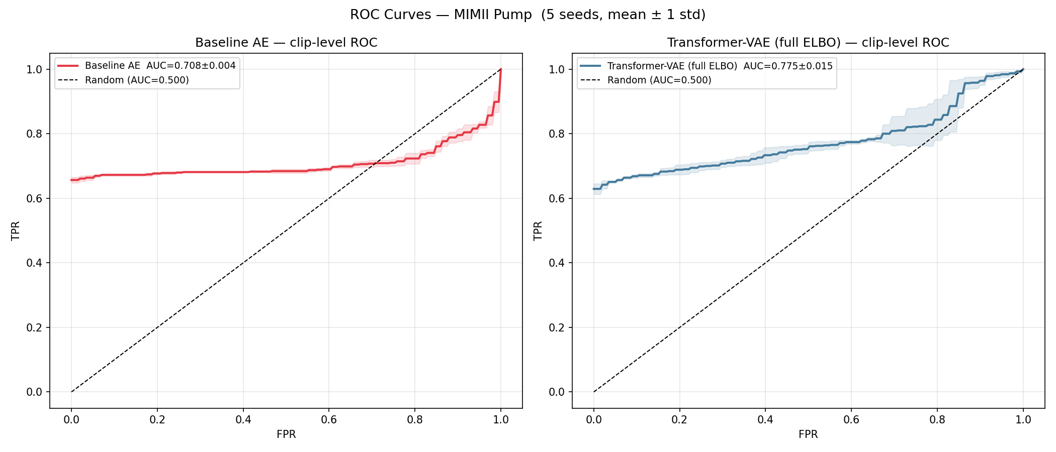 ROC curves, MIMII pump, 5 seeds